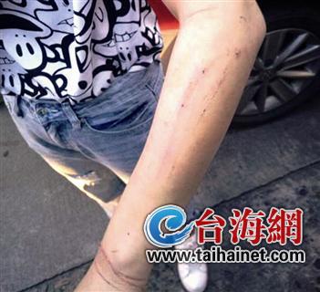 17c吃瓜网免费吃瓜 图片及短视频链接为主海报