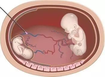 尤物未满 尤物未满程度或状态）”海报