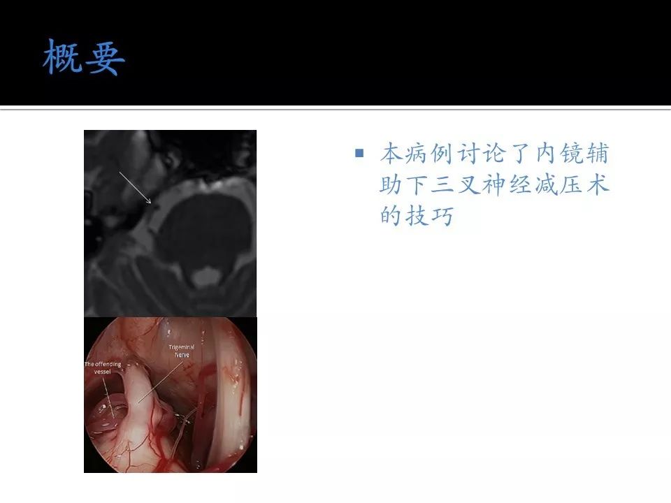 oley fans视频海报