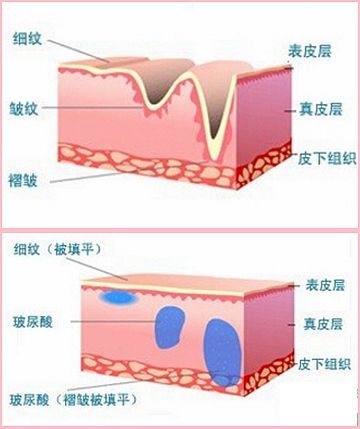 暗黑爆料海报